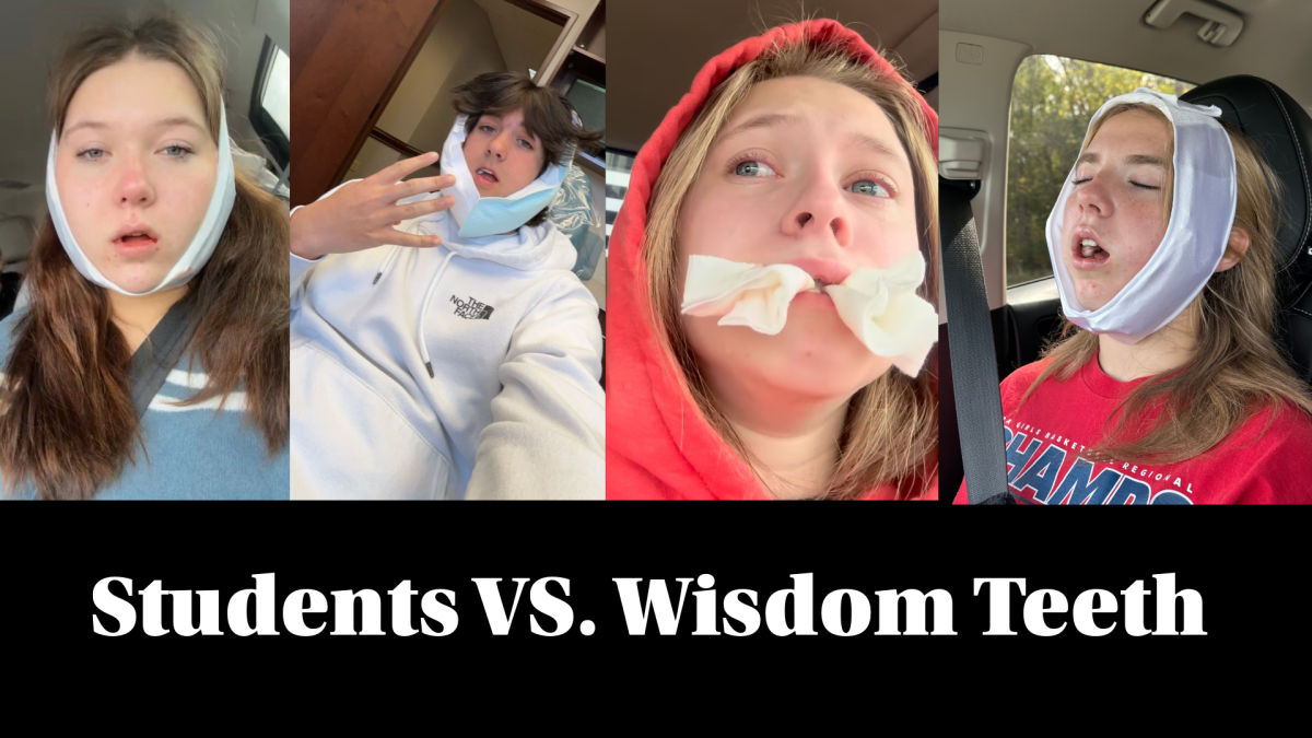 When the Dentist Assigns Homework: Students vs. Wisdom Teeth